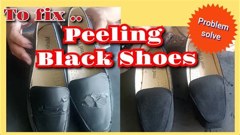 my fake leather shoes peeled inside and dying|leather shoe peeling problems.